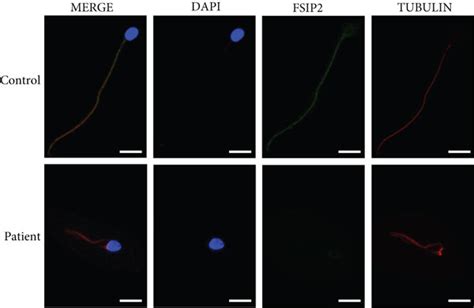 Fsip2 Immunofluorescence Staining In Control And Patient Spermatozoa Download Scientific