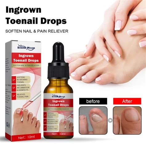 German Toenailplus Anti Paronychia Relief Oil Wowelo Toko Online