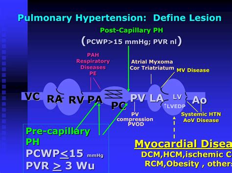 Ppt Pulmonary Hypertension Powerpoint Presentation Free Download