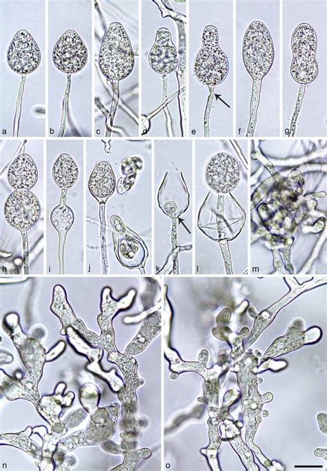 Morphological Structures Of Phytophthora Ukrainensis A L Sporangia