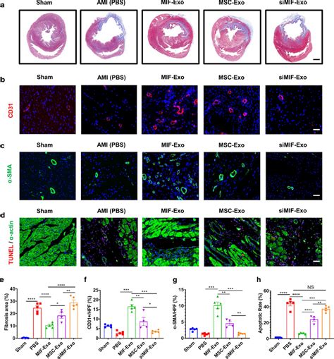 MIF Exo Promoted Angiogenesis And Cardiomyocyte Survival In Infarcted