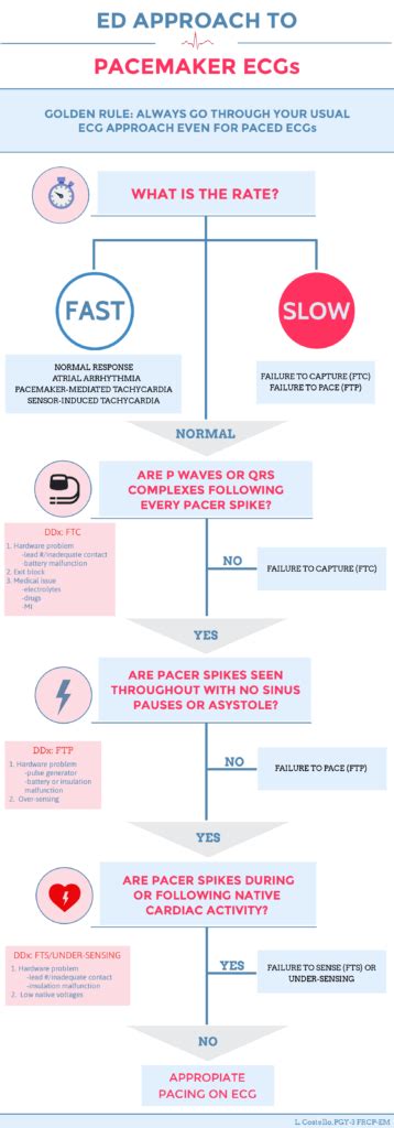 Pacemaker Essentials: How to Interpret a Pacemaker ECG - CanadiEM