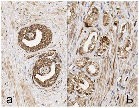 Ijms Free Full Text Psma Epcam Vegf And Grpr As Imaging Targets