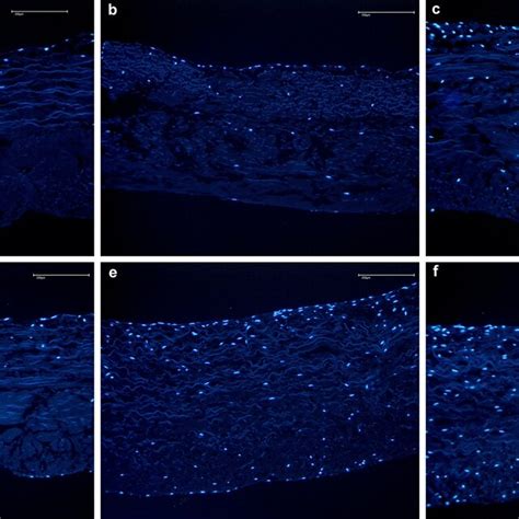 Proliferation And Migration Of B Mscs In The Membrane Without Fibrin