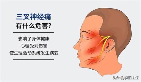 李燕：三叉神經痛有哪些症狀？臉上電擊樣疼痛，小心三叉神經痛 每日頭條