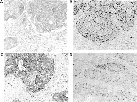 Representative Photomicrographs Of Tissue Sections Immunostained For