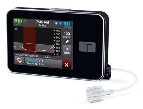 New Tandem Insulin Pump 2024 - Trudy Ingaberg