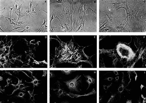 Morphology And Actin Cytoskeleton Of Rsu 1 Transfectants Shown Are Download Scientific Diagram