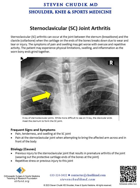 Sternoclavicular (SC) Joint Arthritis - Steven Chudik MD