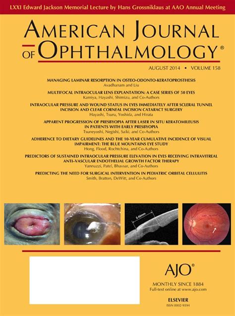 Table Of Contents Page American Journal Of Ophthalmology