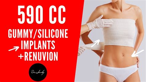 Top Plastic Surgery Breast Augmentation With 590 And 650 Cc Gummy Implants And Lipo With