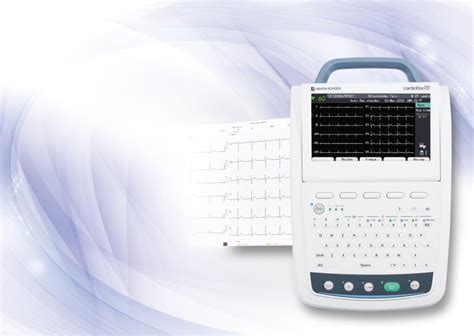 Electrocardi Grafo Ecg Vitae Tecnologia Em Medicina