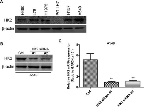 Transfection Efficiency Of Hk2 In Lung Cancer Cell Lines Hk2 Protein Download Scientific