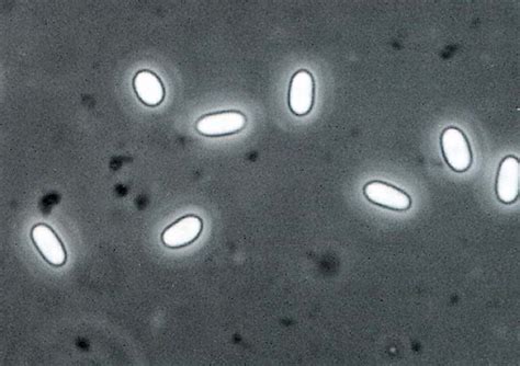 Mature Spores Of Paranosema Locustae Mean Size Microns
