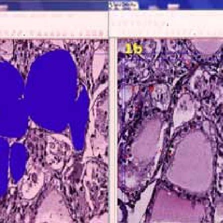 A Photomicrograph Of A Section Of The Thyroid Gland Of A Rat From The