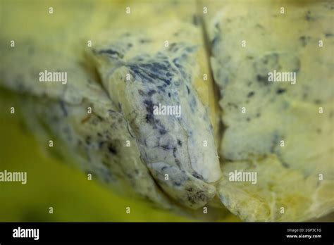 Close Up Of Lung Of A Dead Smoker With Black Spots Forensic Photo Of