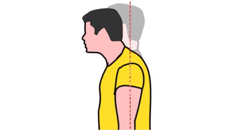 Forward Head Posture: 4 Exercises to get rid of it : Physiosunit