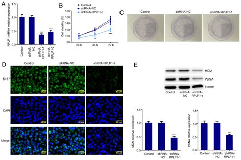 Downregulation Of Rplp1 Inhibits The Proliferation Of Hep3b Cells A Download Scientific