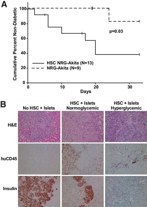 Transplantation Of Human Islet Allografts Into Diabetic Nrgakita Mice