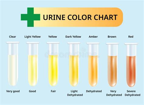 Color Chart Urine Stock Illustrations – 100 Color Chart Urine Stock ...