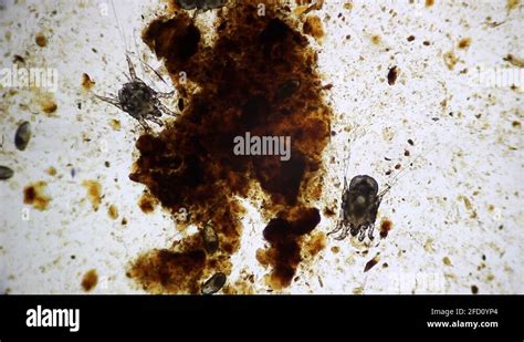 Ear Mite Under Microscope Stock Video Footage Alamy