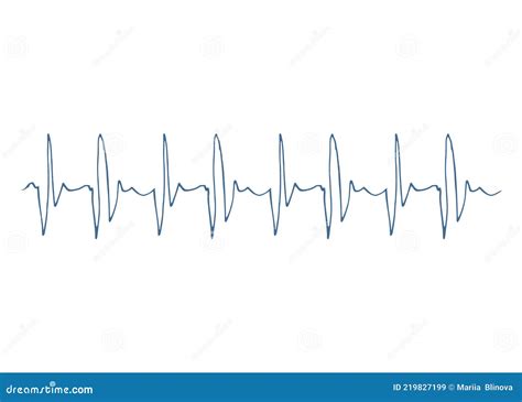 Hart En Vaatziekten Hartslaglijn Cardiogram Elektrocardiogram Ecg