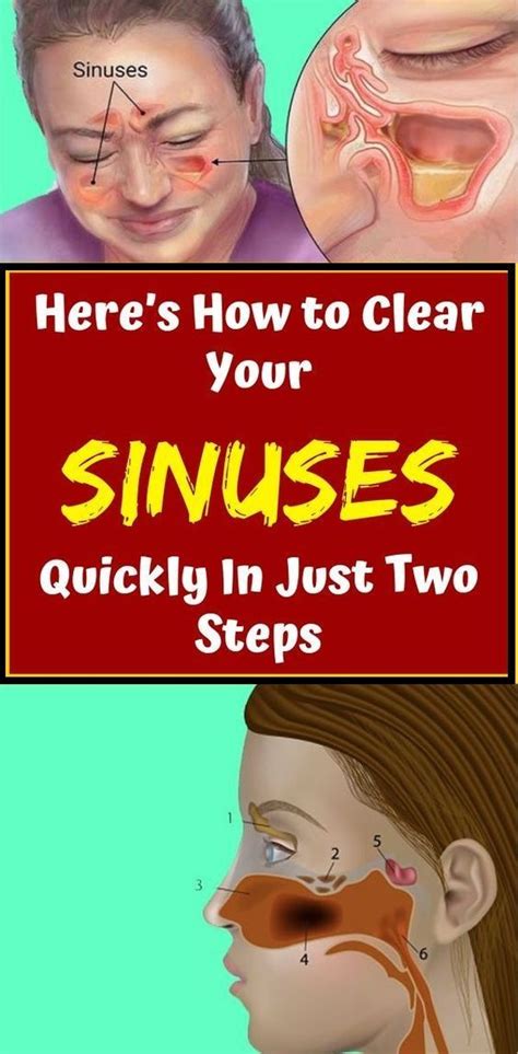 Heres How To Clear Your Sinuses Quickly In Just Two Steps Sinusitis