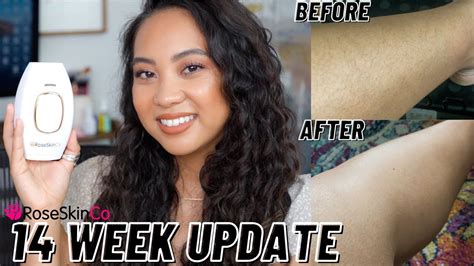 Roseskinco Week Update Ipl Laser Hair Removal Final Results Youtube