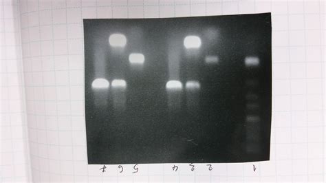 Why do I have many different PCR results on gel electrophoresis despite ...