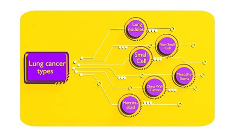 Cancer Cell Infographic Lung Cancer Cells Types Style Tumor