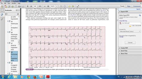 Pulmonary Vascular Disease Pptx D Majeed Muhadharaty