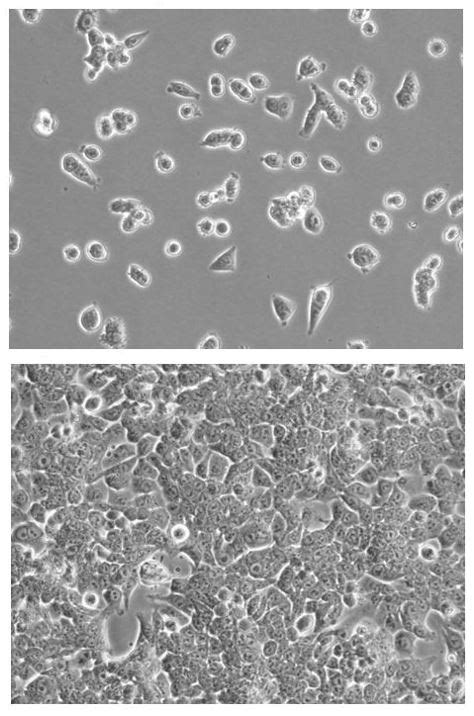 HCT116 Fluc Puro Reporter Gene Cell Line Imanis Life Sciences