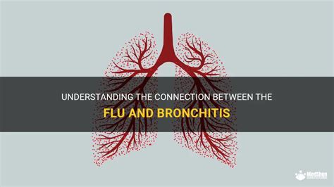 Understanding The Connection Between The Flu And Bronchitis Medshun