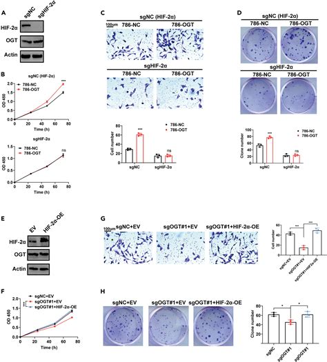 Ogt Hif Axis Promotes The Progression Of Clear Cell Renal Cell