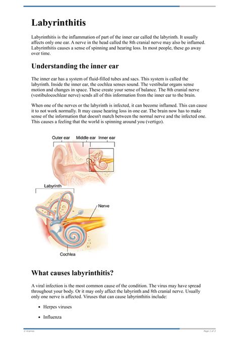 Text Labyrinthitis Healthclips Online