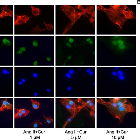 Curcumin Reversed Ang IIinduced Rearrangement Of Factin In Podocytes