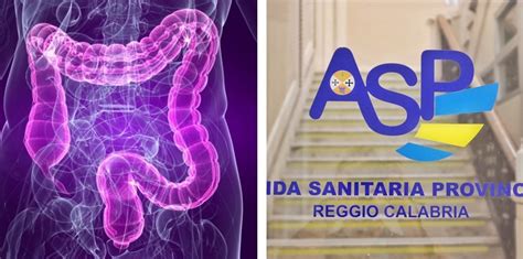 L Asp Di Reggio Avvia Screening Gratuito Per Prevenire Tumori Del Colon