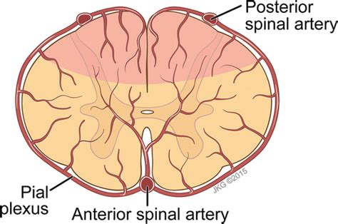 Incomplete Cord Syndromes Clinical And Imaging Review Radiographics