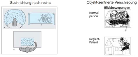 Vl R Umliche Aufmerksamkeit Pt Flashcards Quizlet