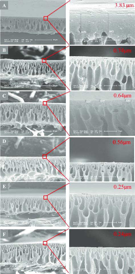 Cross Sectional Sem Images Of Nanofiltration Membrane Prepared With The