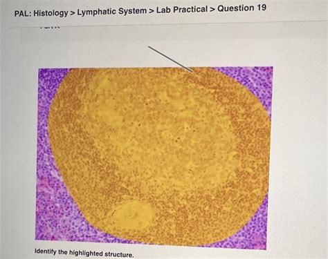 Solved Id Pal Histology Lymphatic System Lab Practical Chegg