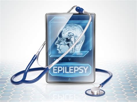 What Causes Epilepsy? - NowPatient