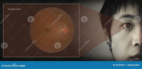 Retinal Scan Royalty-Free Stock Photo | CartoonDealer.com #5549367