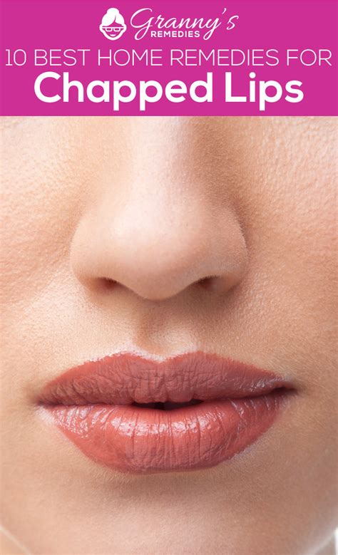 10 Best Home Remedies For Chapped Lips Grannys Remedies