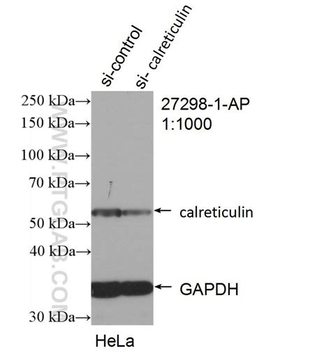 Calreticulin Antibody 27298 1 Ap Proteintech