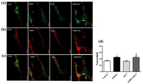 Ijms Free Full Text Effect Of The Flavonoid Rutin On The Modulation