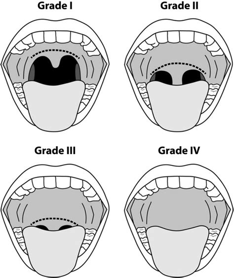 Guidelines For Sedation And Anesthesia In Gi Endoscopy Gastrointestinal Endoscopy