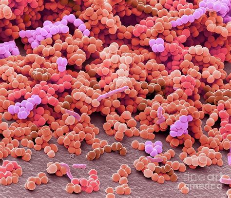 Folliculitis Bacteria Photograph By Steve Gschmeissnerscience Photo