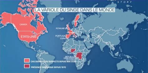 Un Cas Suspect De Variole Du Singe En France Il Faut Rester Tr S