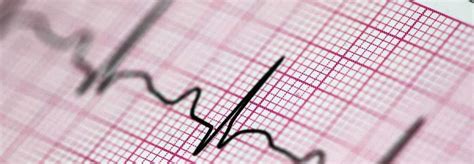 Are ECG and EKG the same? - ROOEMED